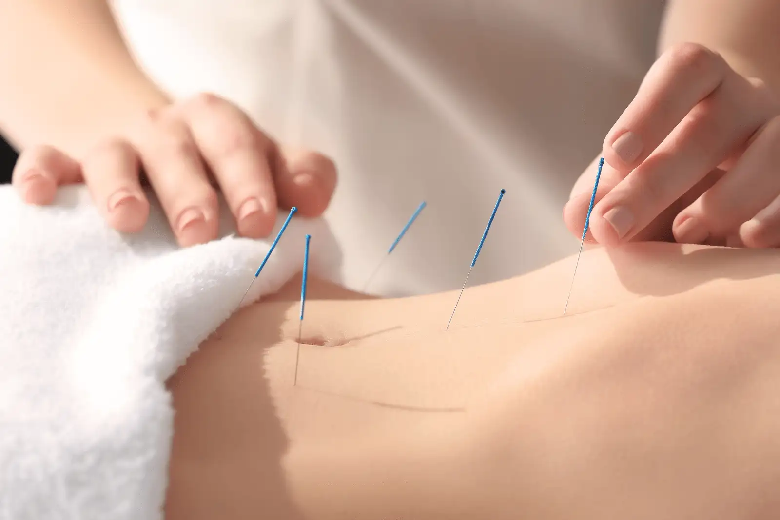 Acupuncture for Better Balance, Pain Relief, and Relaxation